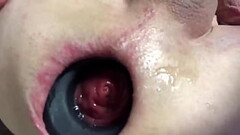 ANAL GAPING ANAL PROLAPSING ANAL VACUUM PUMPING COMPILATION Thumb